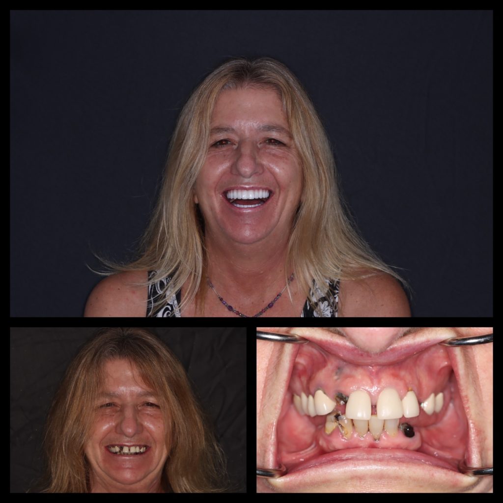 Compliation of 3 before and after photos of a patient.