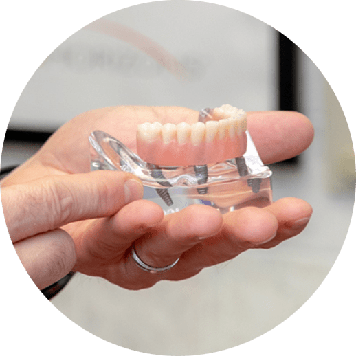 Dental Implants