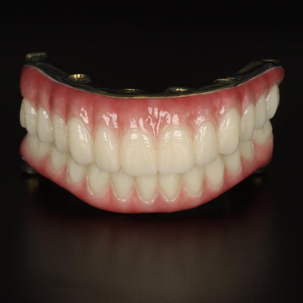 A full set of artificial upper and lower teeth with pink gum bases displayed on a dark surface.