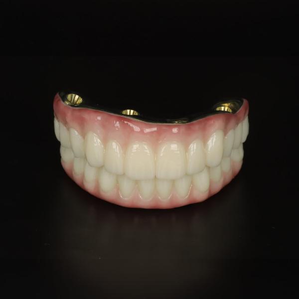 A set of artificial upper and lower dentures with pink gums and white teeth displayed against a black background.