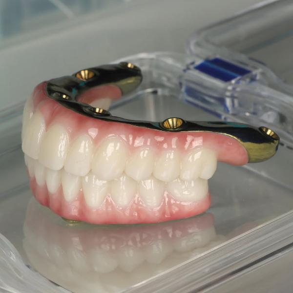 A dental prosthesis with artificial teeth and pink gums mounted on a metal implant framework, placed on a clear plastic surface.