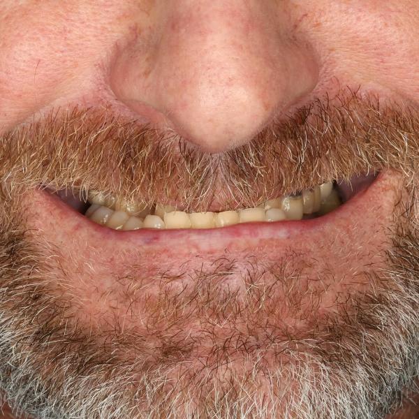 Close-up of the lower half of a man's face with a brown and gray beard, mustache, and slightly yellowed teeth visible as he smiles.