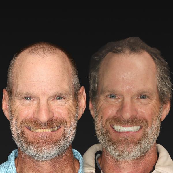 Two middle-aged men with similar facial features and beards, standing side by side and smiling against a black background.