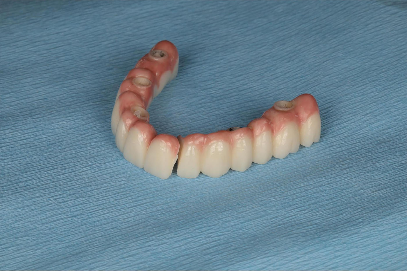 upper artificial dentures