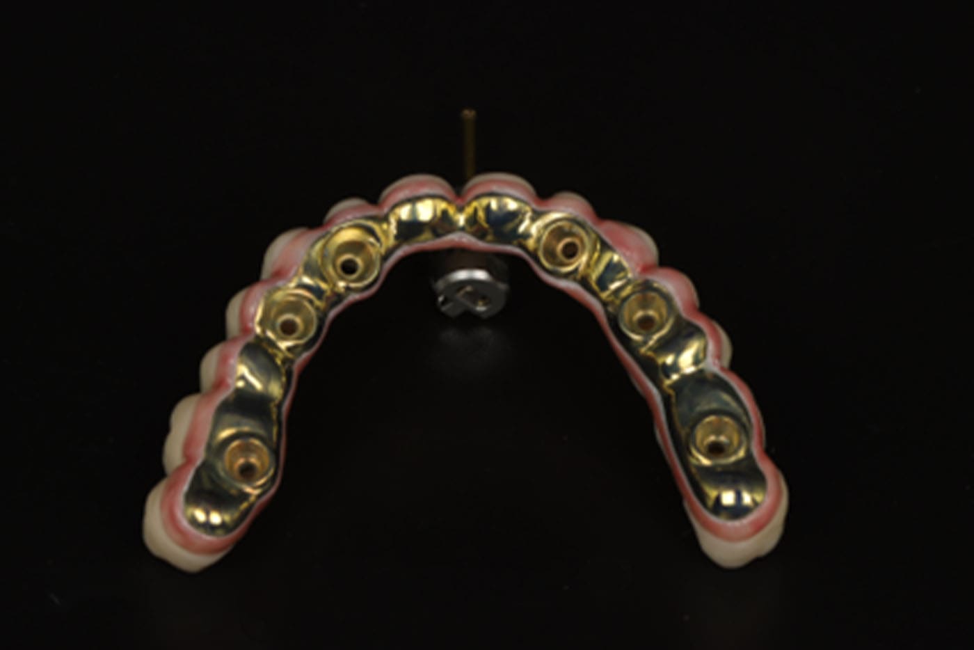 upper artificial dentures with a metal framework, displayed in a clear plastic case.