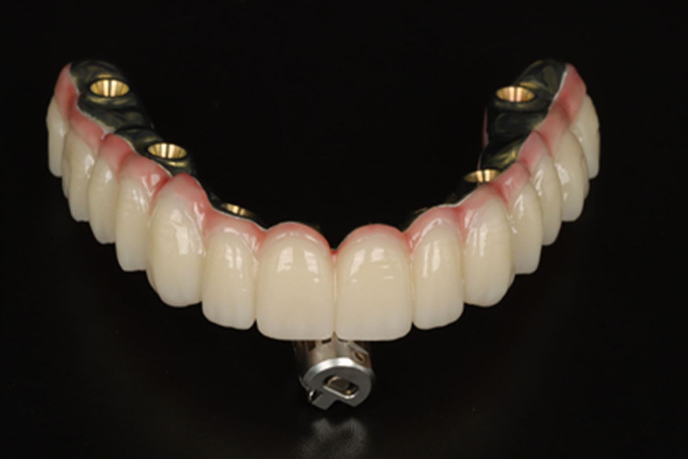 upper artificial dentures with a metal framework, displayed in a clear plastic case.