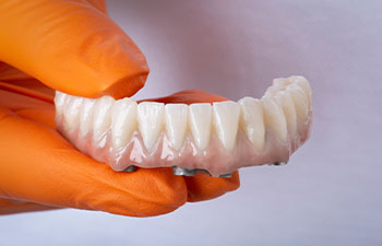 Zirconia crowns on titanium bar
