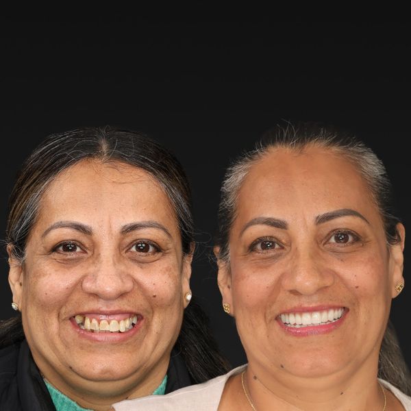 Before and after, woman smiling against a black background.