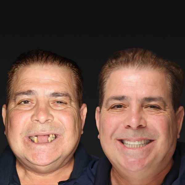 Before and after, man smiling against a black background.