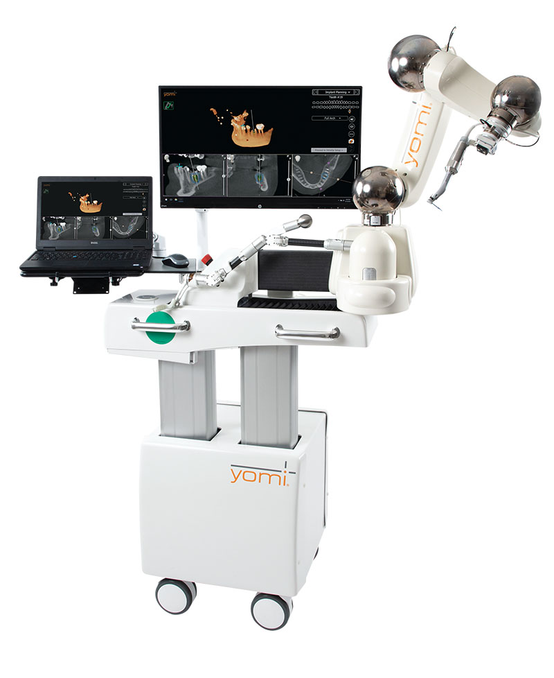 A dental robotic system with a computer screen, articulating robotic arm, and dental equipment labeled "Yomi" on a wheeled base.
