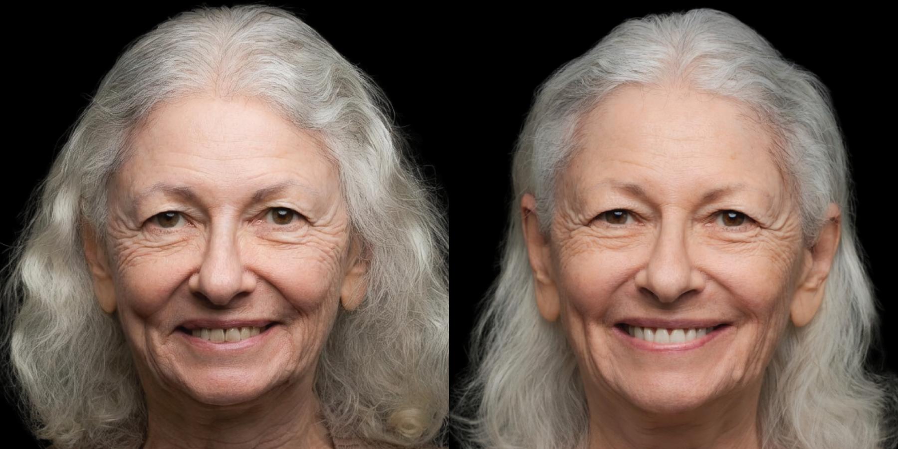 Before and after, woman smiling against a black background.