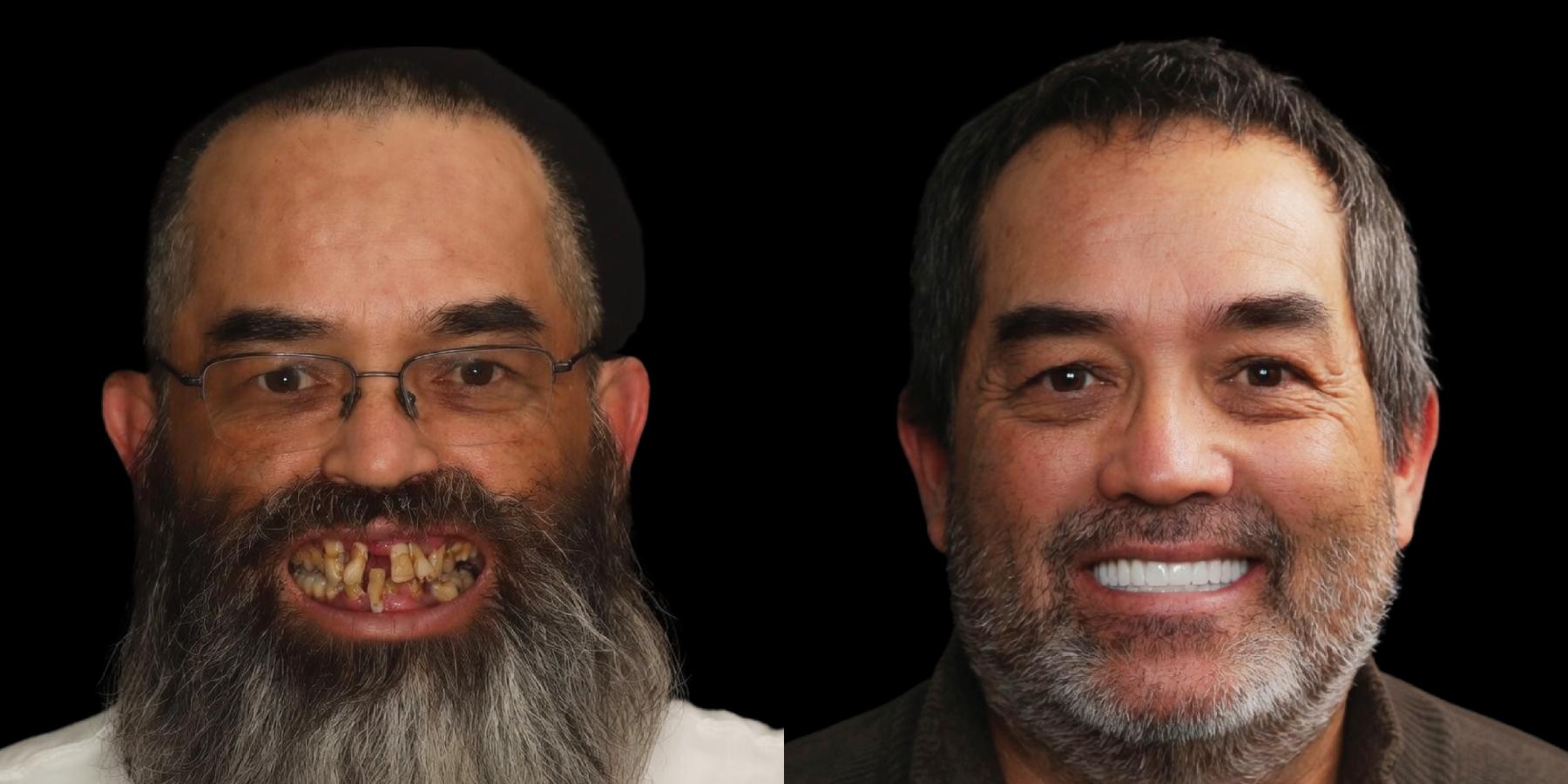 Before and after, man smiling against a black background.