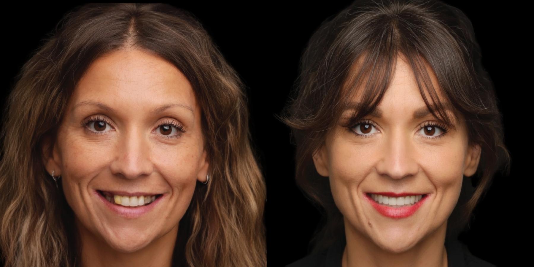 Before and after, woman smiling against a black background.